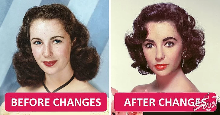 ۱۱ حقیقتی که ثابت می کند عمل های زیبایی از گذشته وجود داشتند